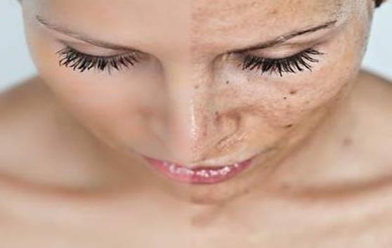 ENFERMEDADES DE LA PIEL MUY COMUNES EN LAS MUJERES - Megalindas
