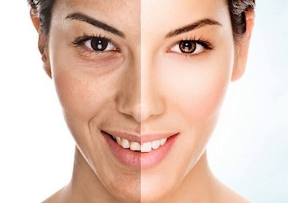Como obtener un cutis radiante y perfecto