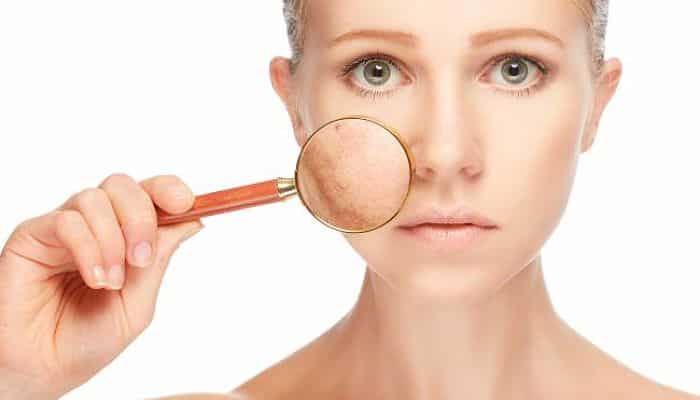 Como Eliminar Las Manchas En La Cara - Consejos Prácticos