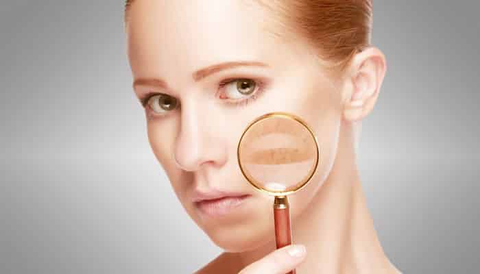 Como Eliminar Manchas En La Piel Con Remedios Naturales!