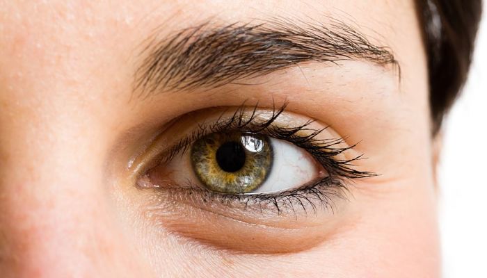 Como Quitar Las Bolsas De Los Ojos Y Ojeras Con 7 Remedios Caseros