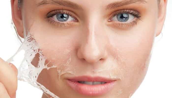 16 Cremas Caseras Para Pieles Grasas Totalmente Naturales Y Efectivos