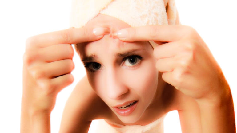 acné en el rostro