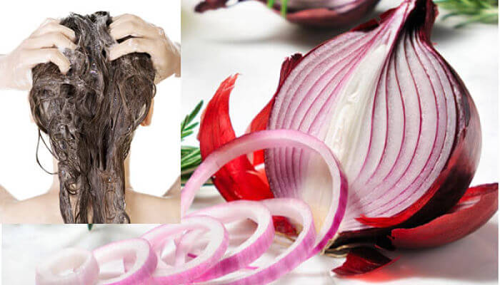 jugo de cebolla para evitar la caída del cabello