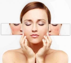 6 tips para disminuir las manchas faciales