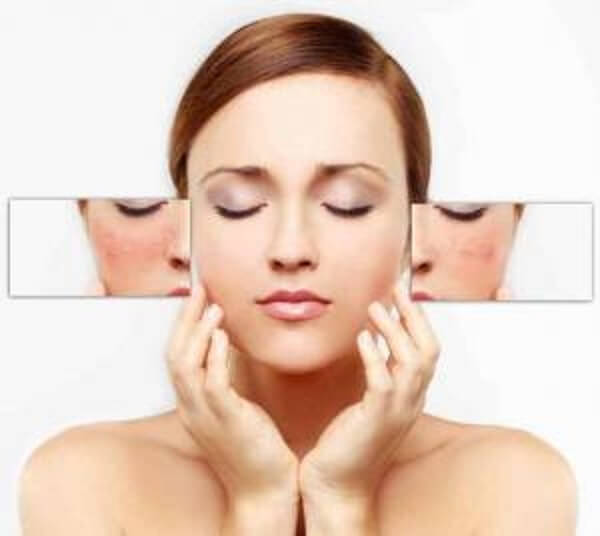 6 Infalibles tips para disminuir las manchas faciales